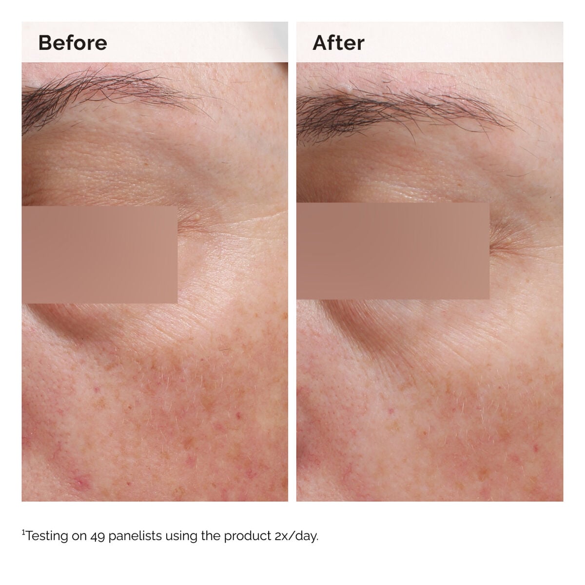 niacinamide-5-face-and-body-emulsion-l1 2024-08-23-ORD-Nia-5pct-Face-Body-B-A-Elasticity-Global-02-1x1.jpg