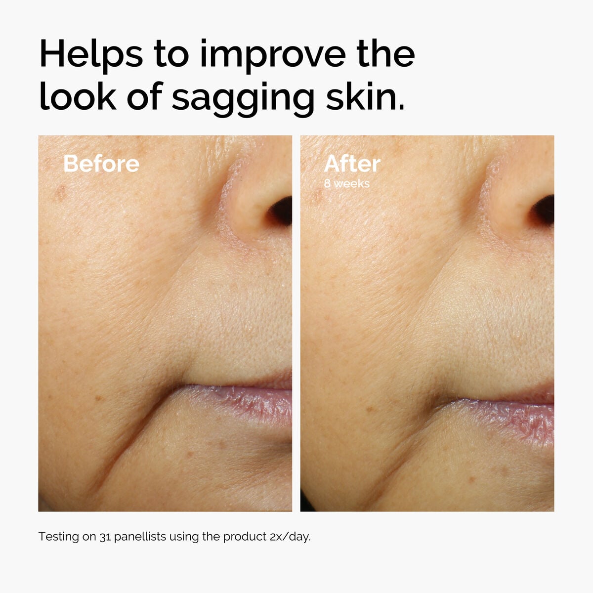 caffeine-3-escin-1-face-serum-h5 ord-caffeine-3pct-escin-1pct-face-serum-before-after-sagging.jpg