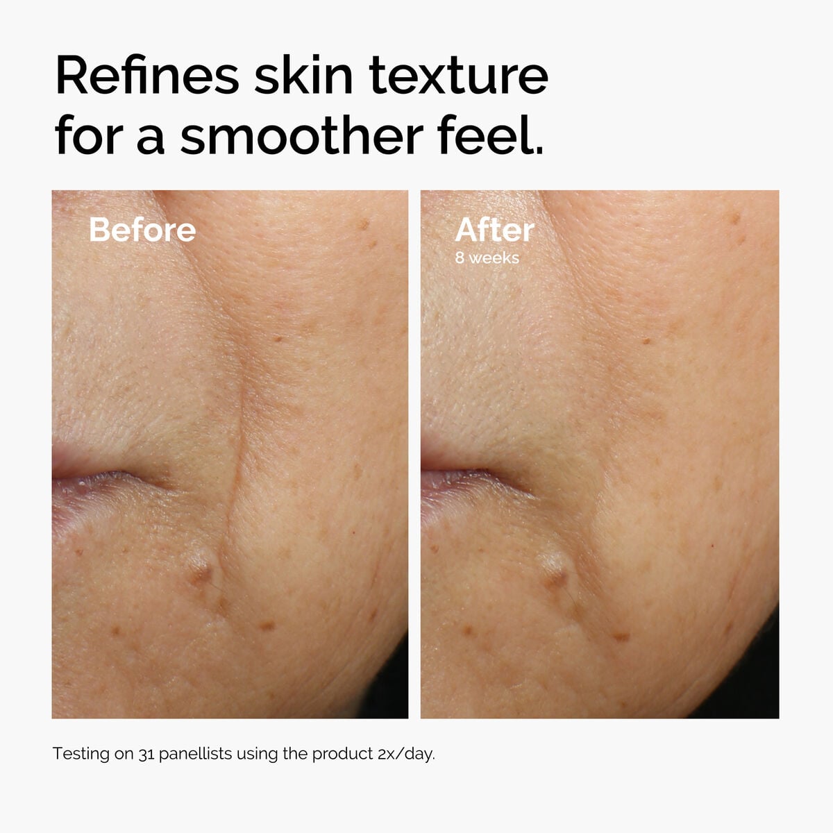 caffeine-3-escin-1-face-serum-h5 ord-caffeine-3pct-escin-1pct-face-serum-before-after-texture.jpg