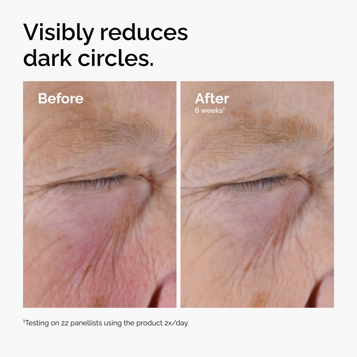 caffeine-solution-5-egcg-eye-serum-k7 ord-caffeine-solution-egcg-dark-circles-before-after.jpg