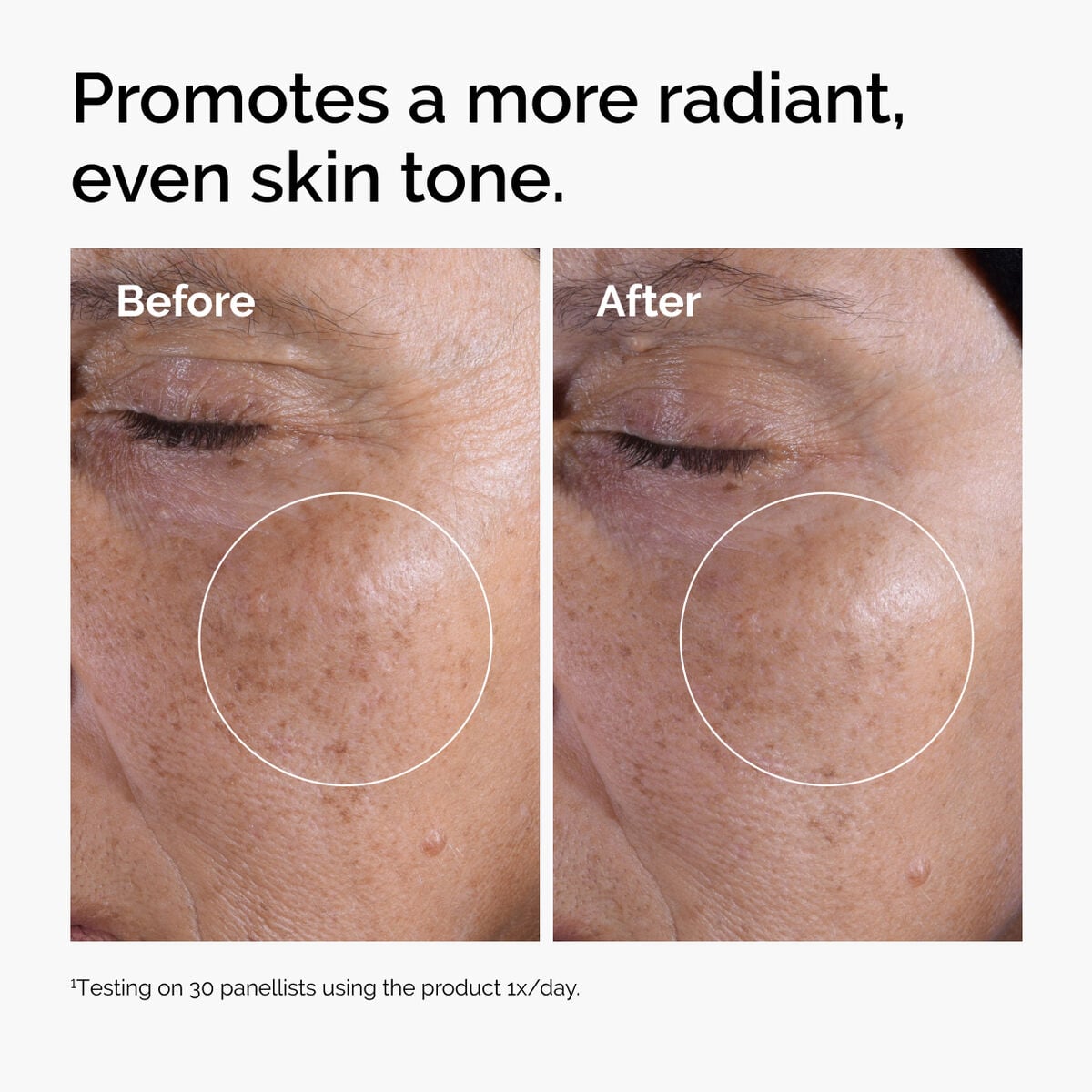 glycolic-acid-7-exfoliating-toner-s3 ord-glycolic-before-after-radiance.jpg