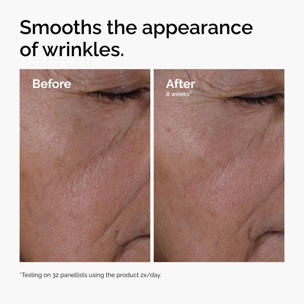 multi-peptide-ha-serum-c4 ord-multi-peptide-ha-serum-wrinkles-before-after.jpg