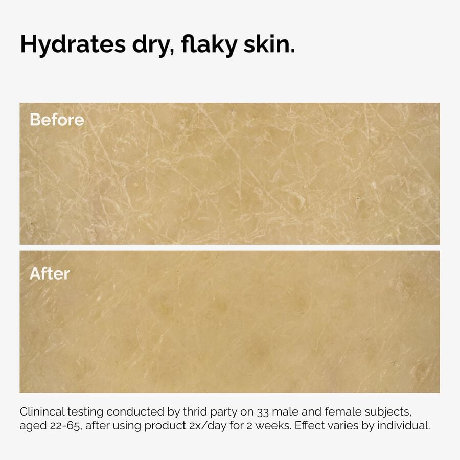 the-body-care-collection-y0 ord-natural-moisturizing-factors-inulin-body-before-after-graphic-02.jpg