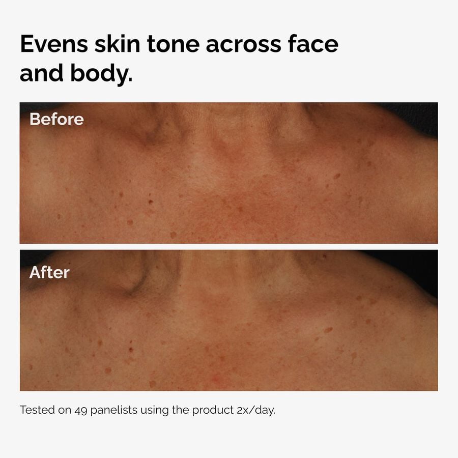 the-body-care-collection-y0 ord-niacinamide-face-body-serum-before-after-even-tone-graphic.jpg