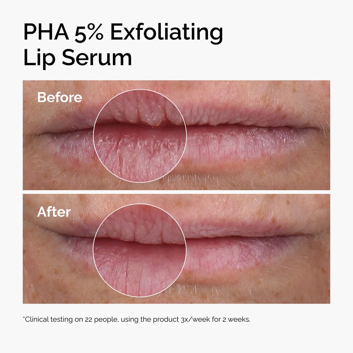 pha-5-exfoliating-lip-serum-n8 ord-pha-5pct-lip-exfoliating-serum-before-after.jpg