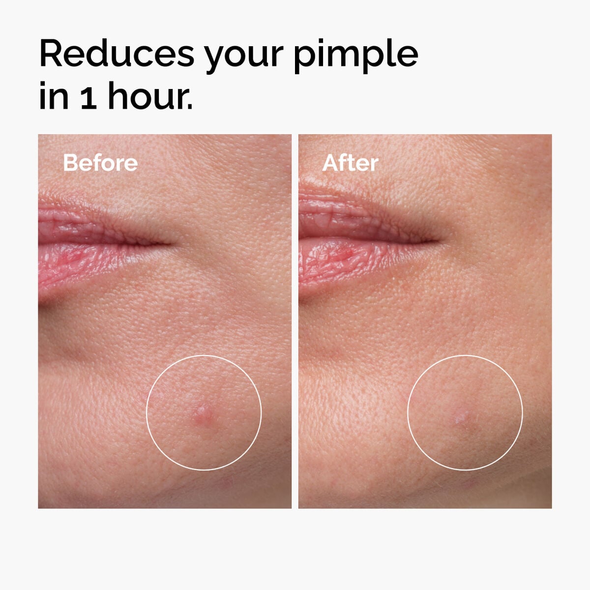 sulfur-10-powder-to-cream-concentrate-d0 ord-sulfur-10pct-powder-to-cream-concentrate-before-after-NA.jpg